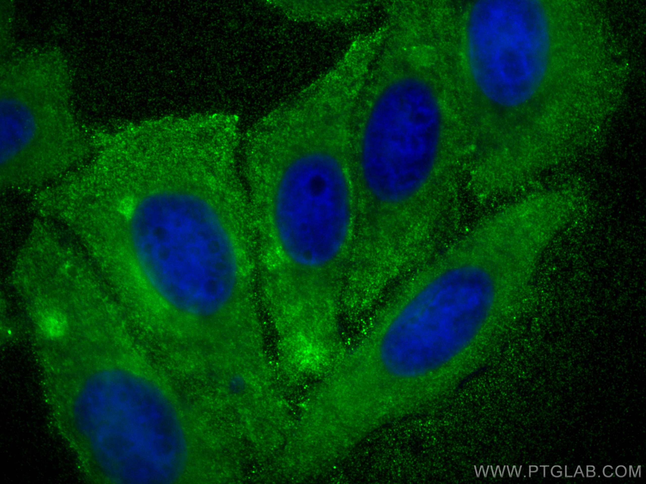 Immunofluorescence (IF) / fluorescent staining of HepG2 cells using TRIM21 Polyclonal antibody (12108-1-AP)