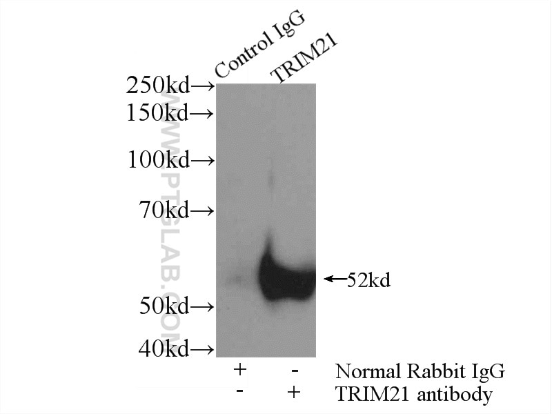 Immunoprecipitation (IP) experiment of A549 cells using TRIM21 Polyclonal antibody (12108-1-AP)