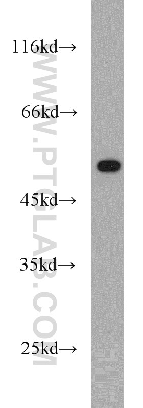 Western Blot (WB) analysis of A549 cells using TRIM21 Polyclonal antibody (12108-1-AP)