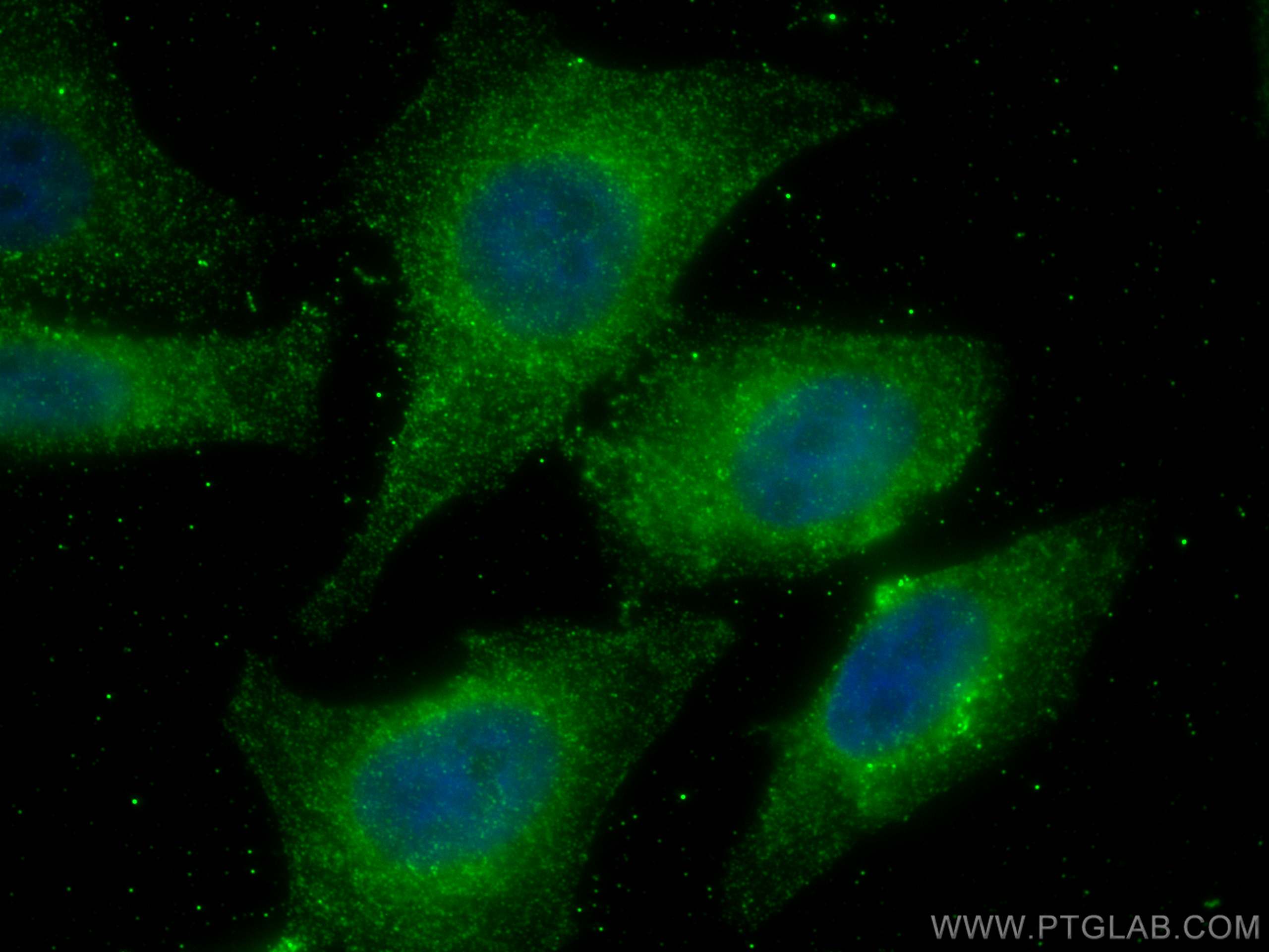 Immunofluorescence (IF) / fluorescent staining of HepG2 cells using TRIM21 Monoclonal antibody (67136-1-Ig)