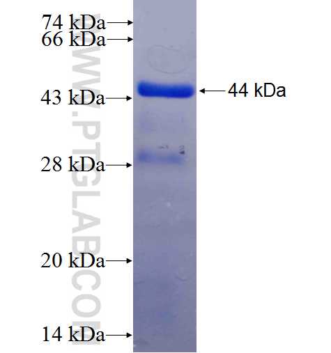 TRIM22 fusion protein Ag6938 SDS-PAGE