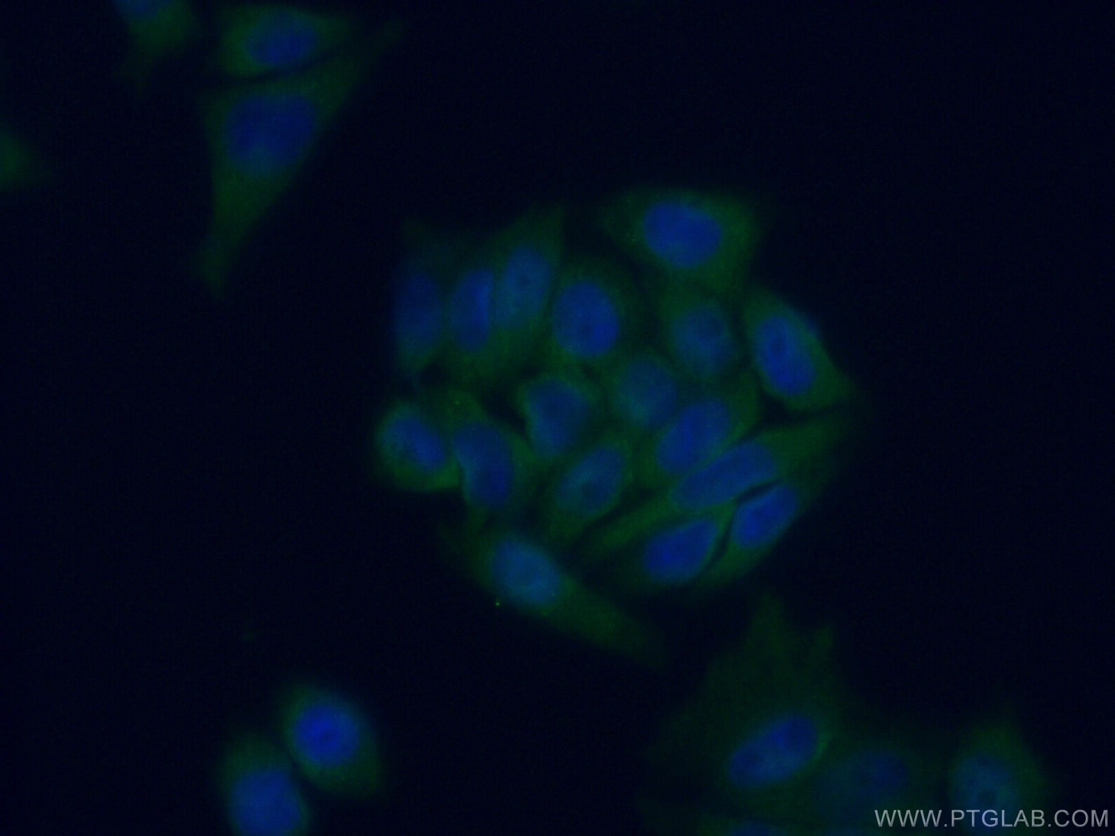 Immunofluorescence (IF) / fluorescent staining of HeLa cells using TRIM23 Polyclonal antibody (12607-1-AP)