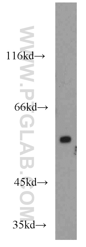 Western Blot (WB) analysis of mouse brain tissue using TRIM23 Polyclonal antibody (12607-1-AP)