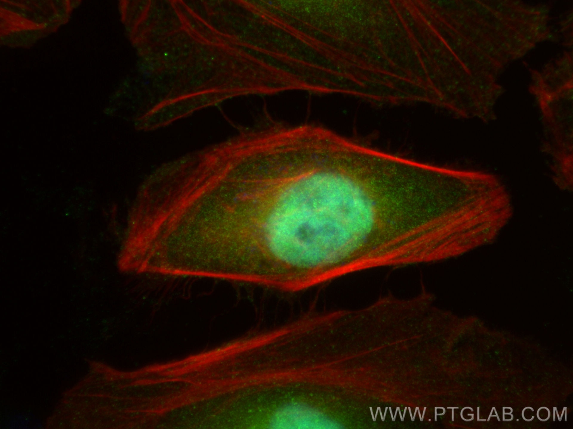 Immunofluorescence (IF) / fluorescent staining of HeLa cells using TRIM24 Polyclonal antibody (14208-1-AP)