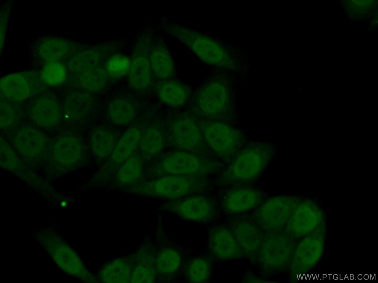 Immunofluorescence (IF) / fluorescent staining of HeLa cells using TRIM24 Polyclonal antibody (14208-1-AP)