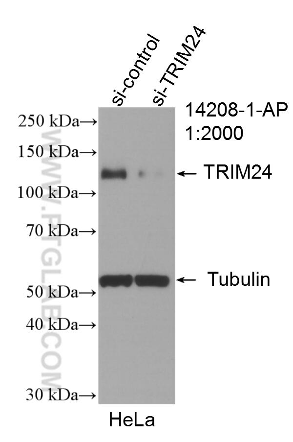 Western Blot (WB) analysis of HeLa cells using TRIM24 Polyclonal antibody (14208-1-AP)