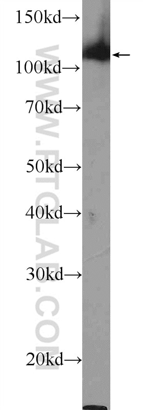 Western Blot (WB) analysis of HeLa cells using TRIM24 Polyclonal antibody (14208-1-AP)