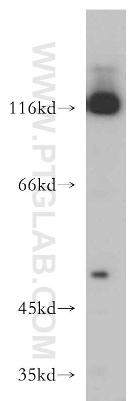 Western Blot (WB) analysis of L02 cells using TRIM24 Polyclonal antibody (14208-1-AP)