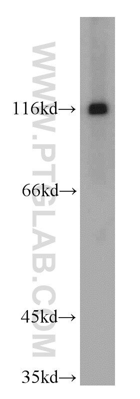 Western Blot (WB) analysis of human heart tissue using TRIM24 Polyclonal antibody (14208-1-AP)