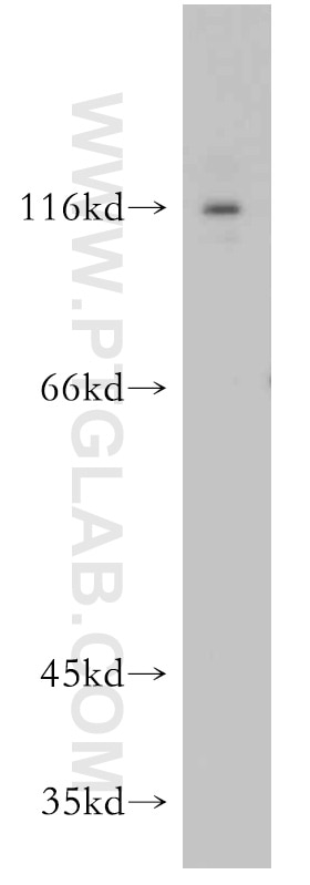 Western Blot (WB) analysis of mouse skeletal muscle tissue using TRIM24 Polyclonal antibody (14208-1-AP)