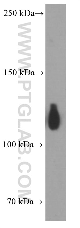 Western Blot (WB) analysis of HeLa cells using TRIM24 Monoclonal antibody (66324-1-Ig)