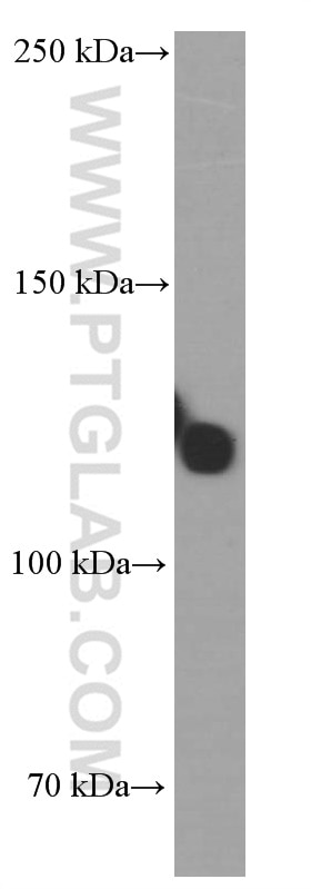 Western Blot (WB) analysis of HEK-293 cells using TRIM24 Monoclonal antibody (66324-1-Ig)