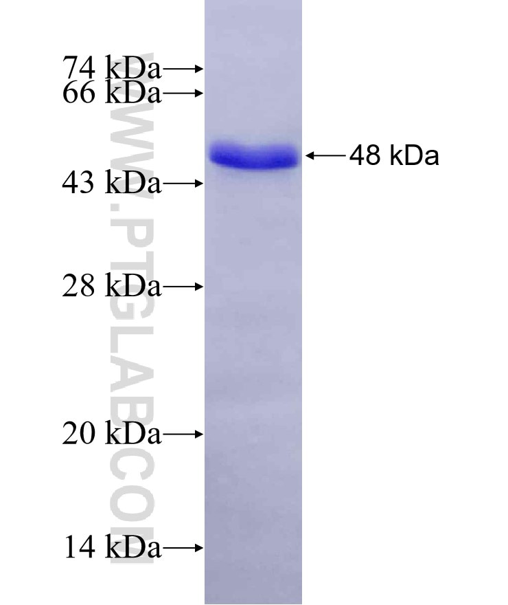 TRIM24 fusion protein Ag5417 SDS-PAGE