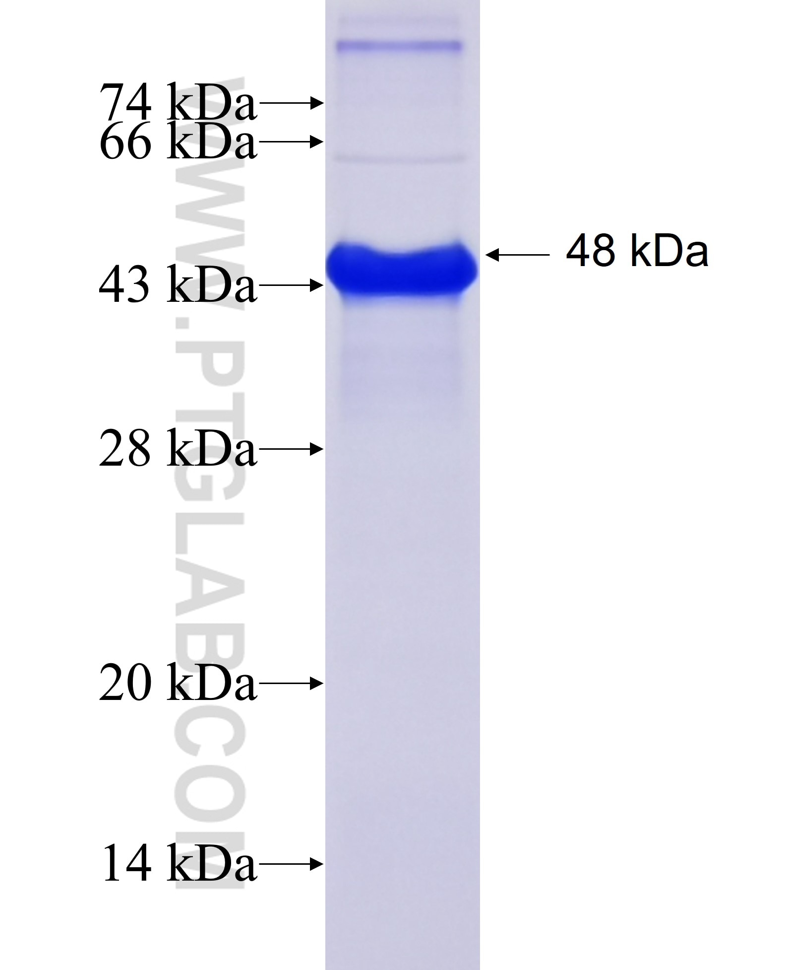 TRIM24 fusion protein Ag5417 SDS-PAGE