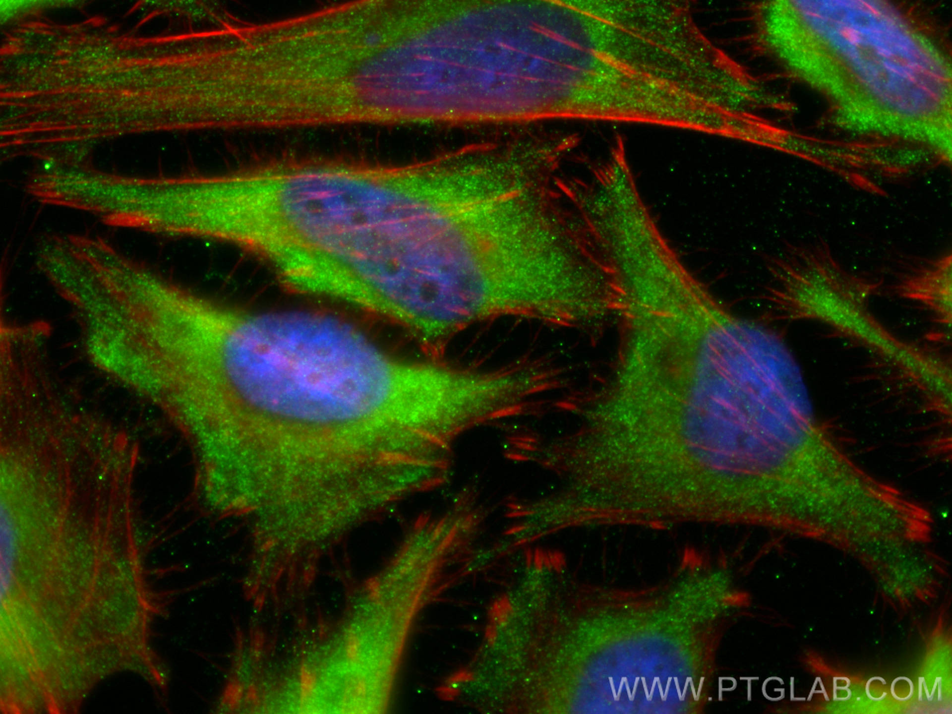 IF Staining of HeLa using 12573-1-AP