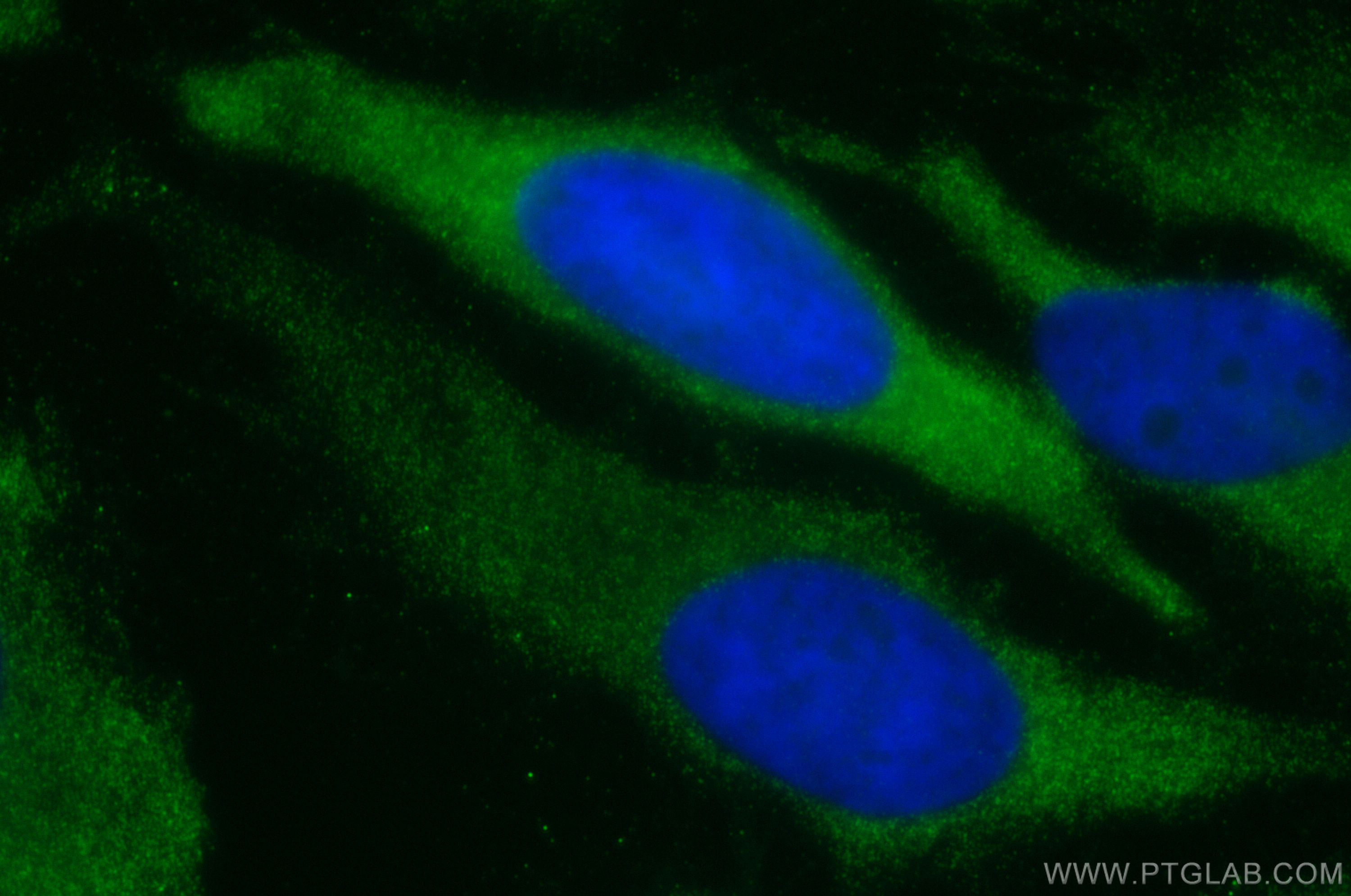 Immunofluorescence (IF) / fluorescent staining of HeLa cells using TRIM25 Polyclonal antibody (12573-1-AP)