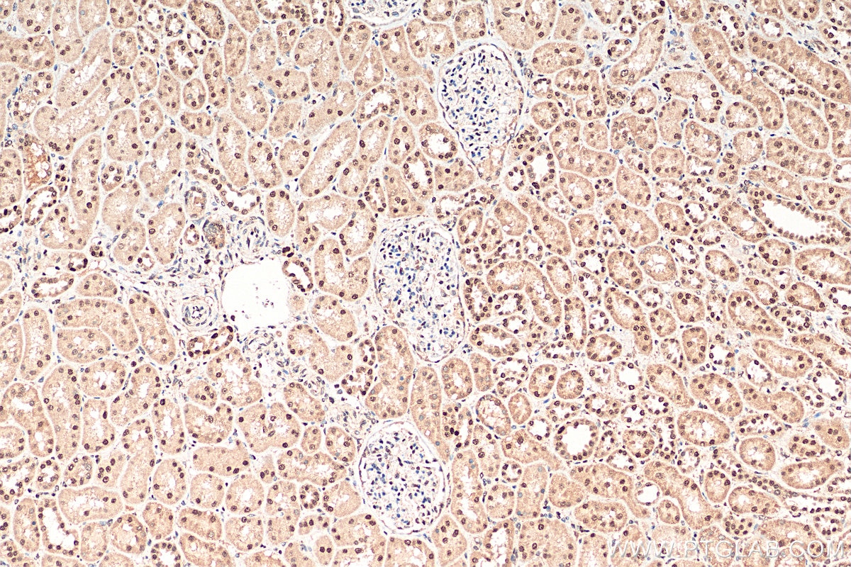 Immunohistochemistry (IHC) staining of human kidney tissue using TRIM25 Polyclonal antibody (12573-1-AP)