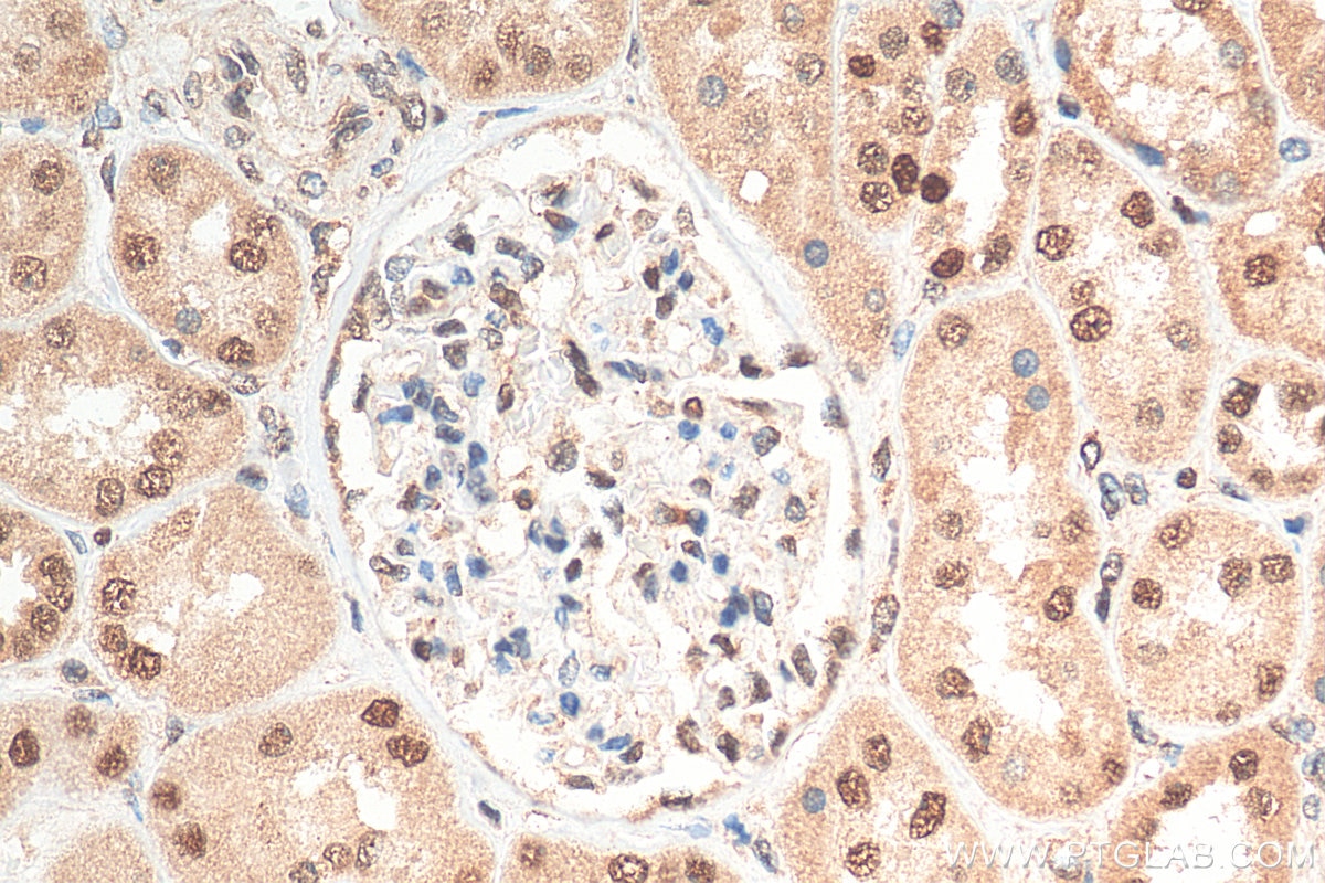 Immunohistochemistry (IHC) staining of human kidney tissue using TRIM25 Polyclonal antibody (12573-1-AP)