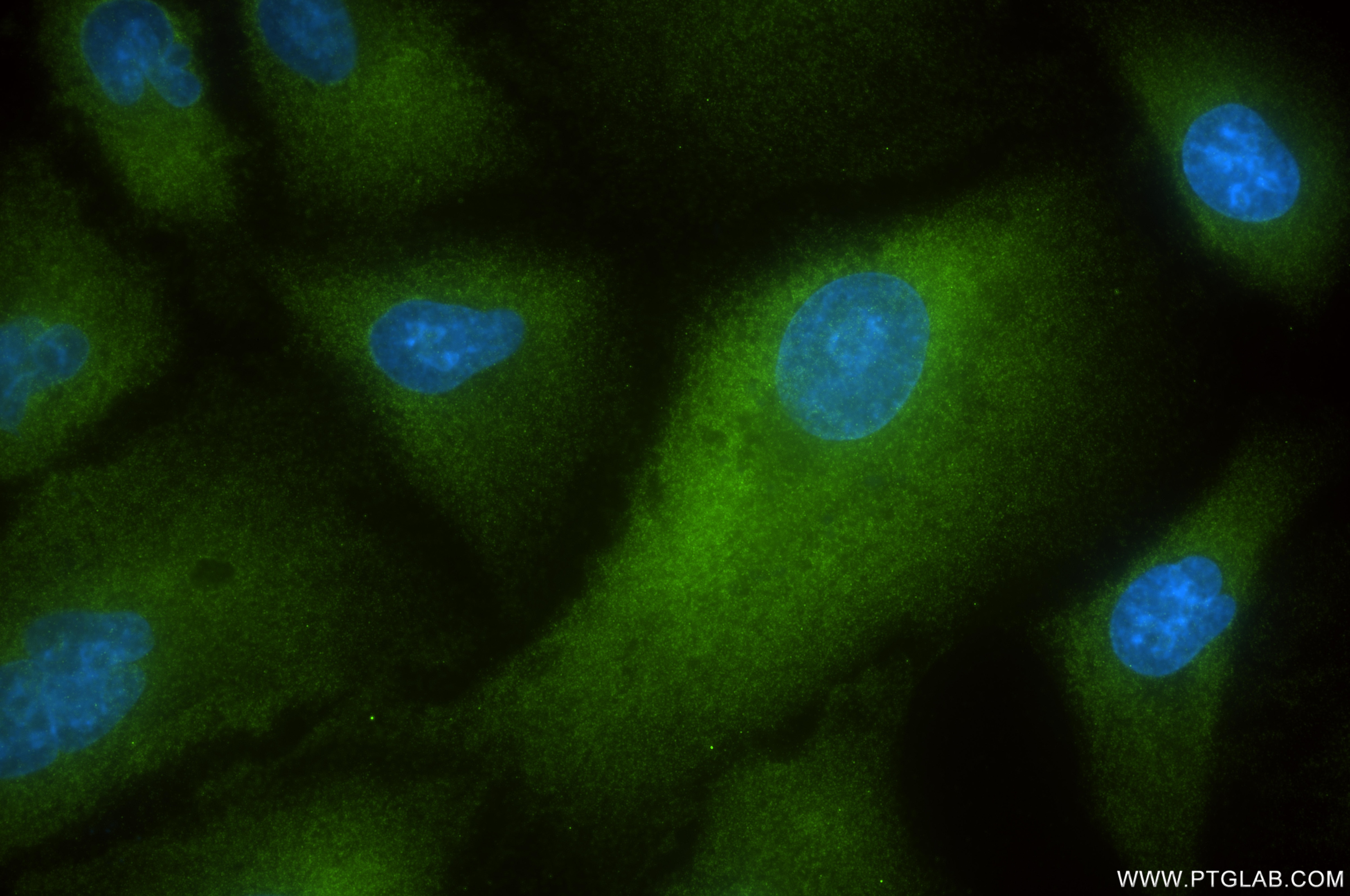 Immunofluorescence (IF) / fluorescent staining of A549 cells using TRIM25 Recombinant antibody (85919-1-RR)