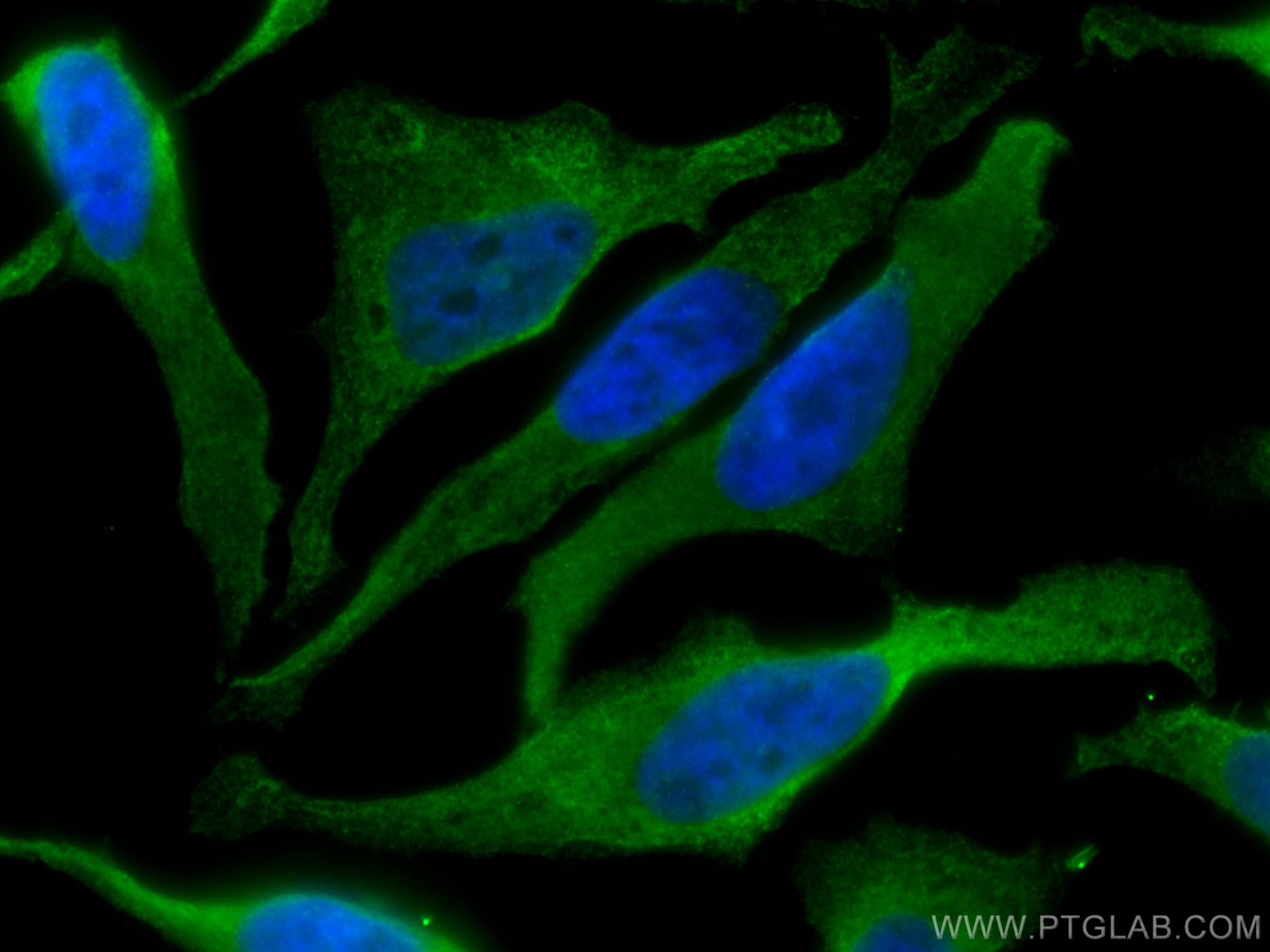 Immunofluorescence (IF) / fluorescent staining of HeLa cells using CoraLite® Plus 488-conjugated TRIM25 Monoclonal an (CL488-67314)