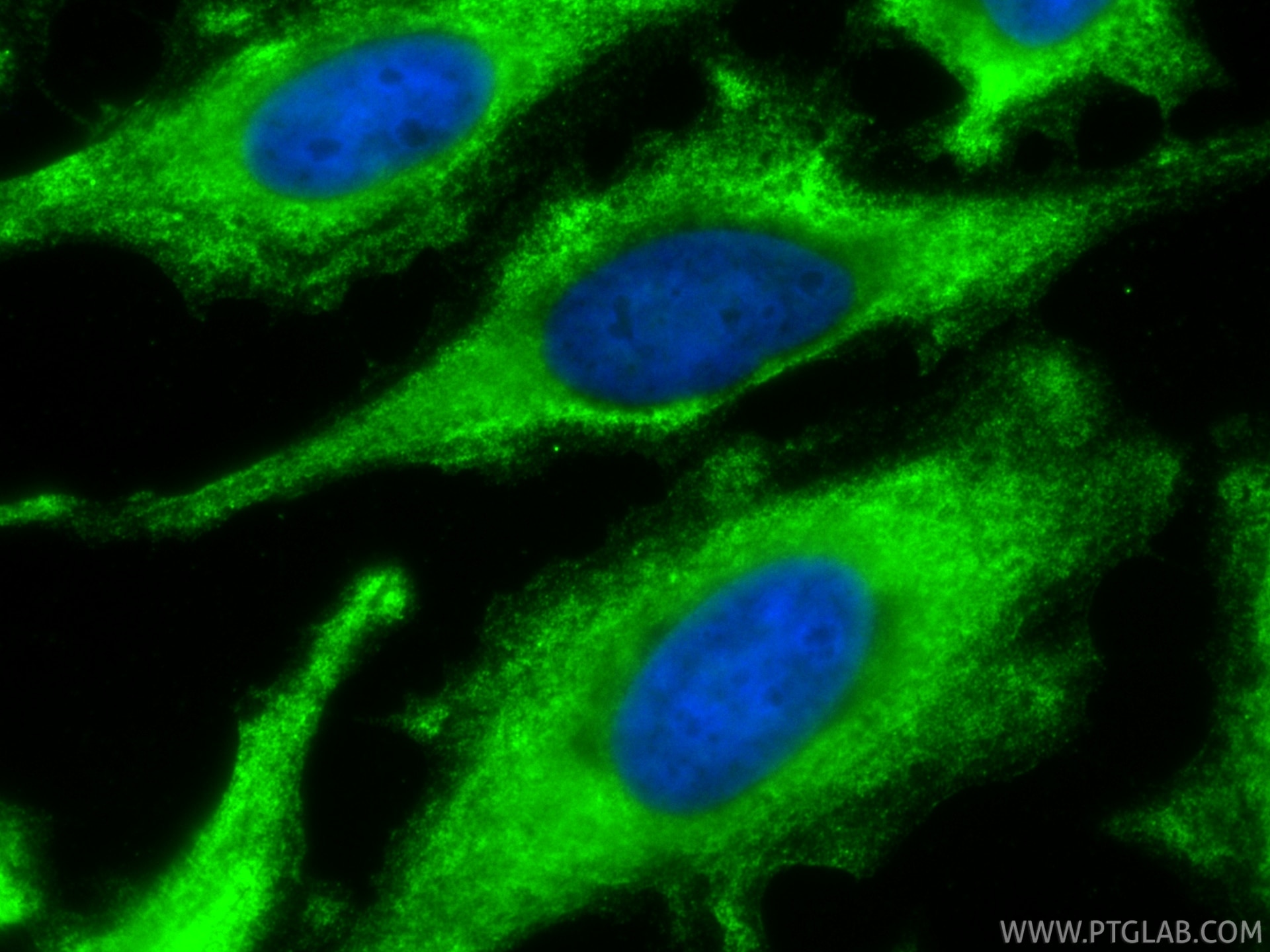 Immunofluorescence (IF) / fluorescent staining of HeLa cells using CoraLite® Plus 488-conjugated TRIM25 Monoclonal an (CL488-67314)