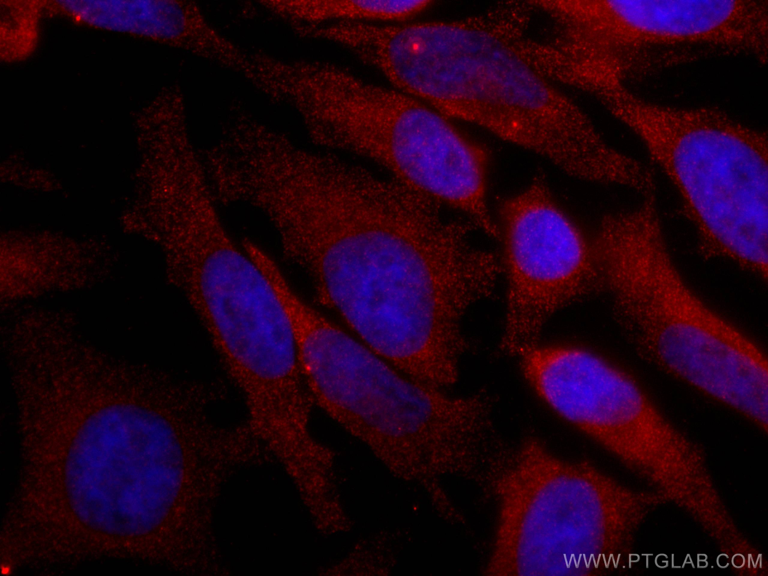 Immunofluorescence (IF) / fluorescent staining of HeLa cells using CoraLite®594-conjugated TRIM25 Monoclonal antibody (CL594-67314)