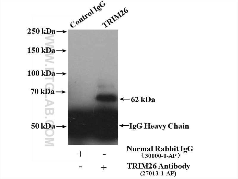 Immunoprecipitation (IP) experiment of HeLa cells using TRIM26 Polyclonal antibody (27013-1-AP)