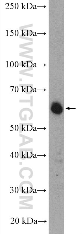 Western Blot (WB) analysis of mouse testis tissue using TRIM26 Polyclonal antibody (27013-1-AP)