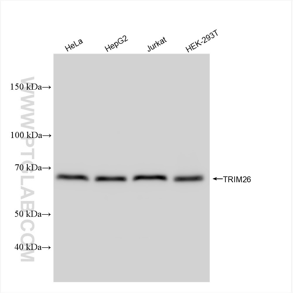 Western Blot (WB) analysis of various lysates using TRIM26 Recombinant antibody (84661-4-RR)