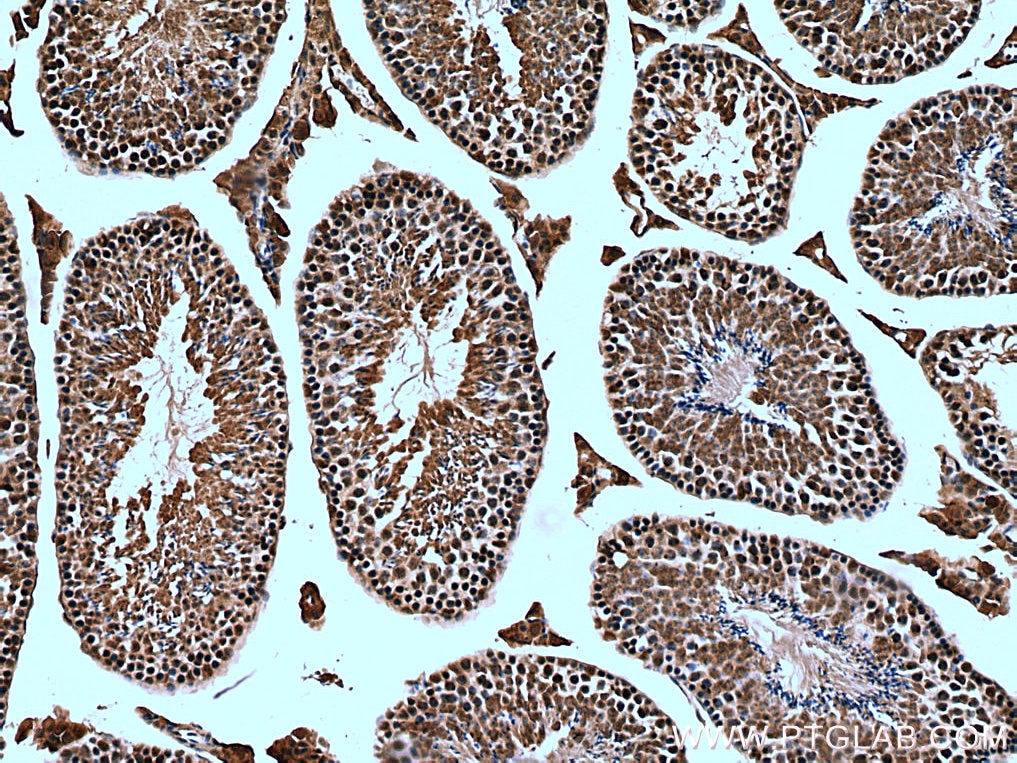 Immunohistochemistry (IHC) staining of mouse testis tissue using TRIM27 Polyclonal antibody (12205-1-AP)