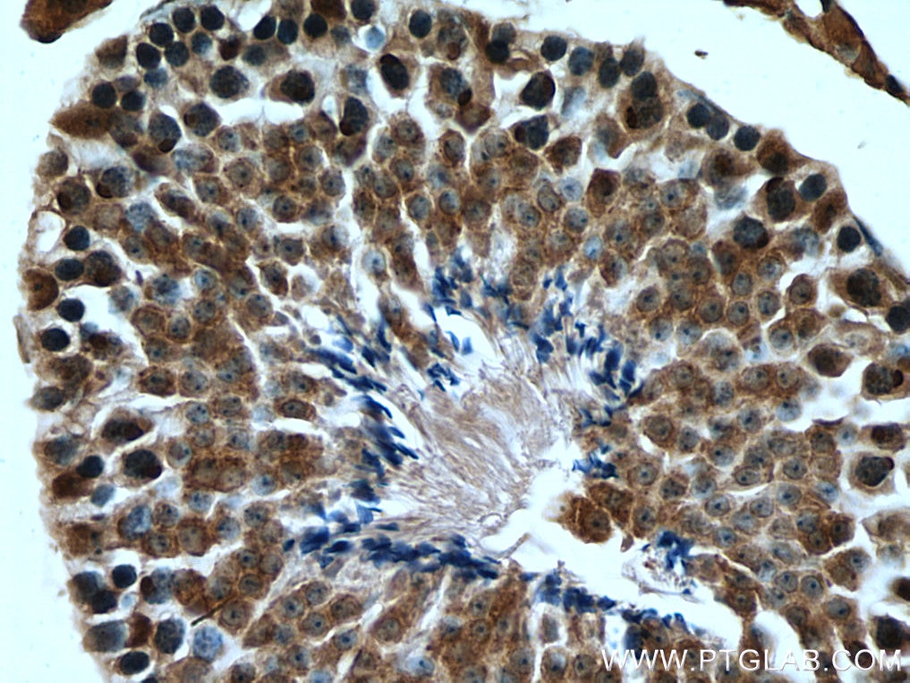 Immunohistochemistry (IHC) staining of mouse testis tissue using TRIM27 Polyclonal antibody (12205-1-AP)
