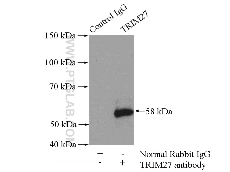 Immunoprecipitation (IP) experiment of mouse testis tissue using TRIM27 Polyclonal antibody (12205-1-AP)