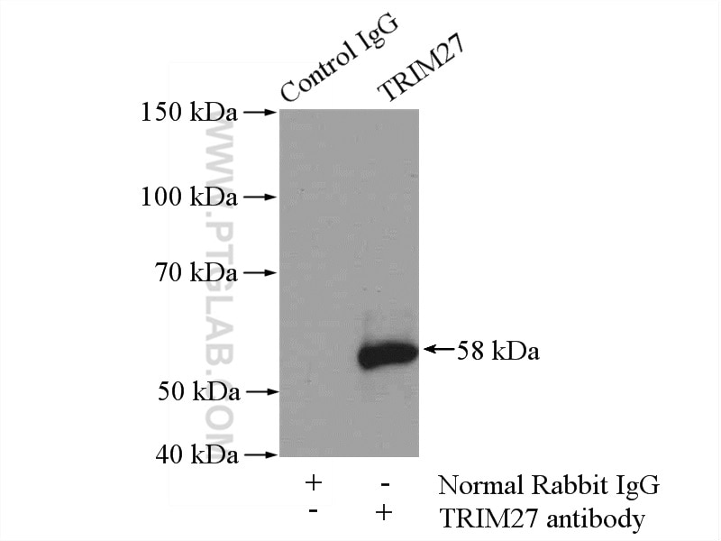 IP experiment of mouse testis using 12205-1-AP