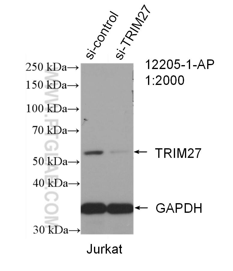 Western Blot (WB) analysis of Jurkat cells using TRIM27 Polyclonal antibody (12205-1-AP)