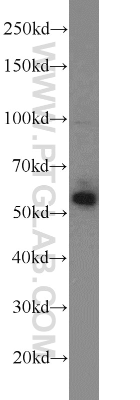 Western Blot (WB) analysis of mouse testis tissue using TRIM27 Polyclonal antibody (12205-1-AP)