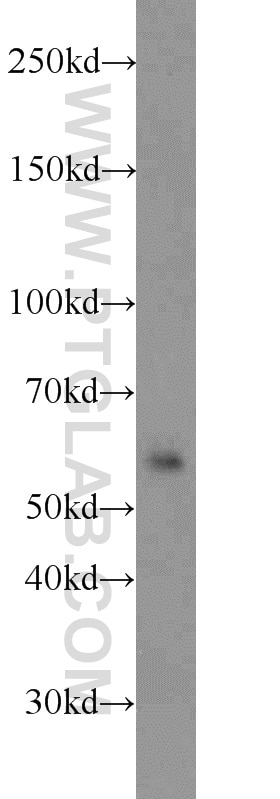 Western Blot (WB) analysis of Jurkat cells using TRIM27 Polyclonal antibody (12205-1-AP)