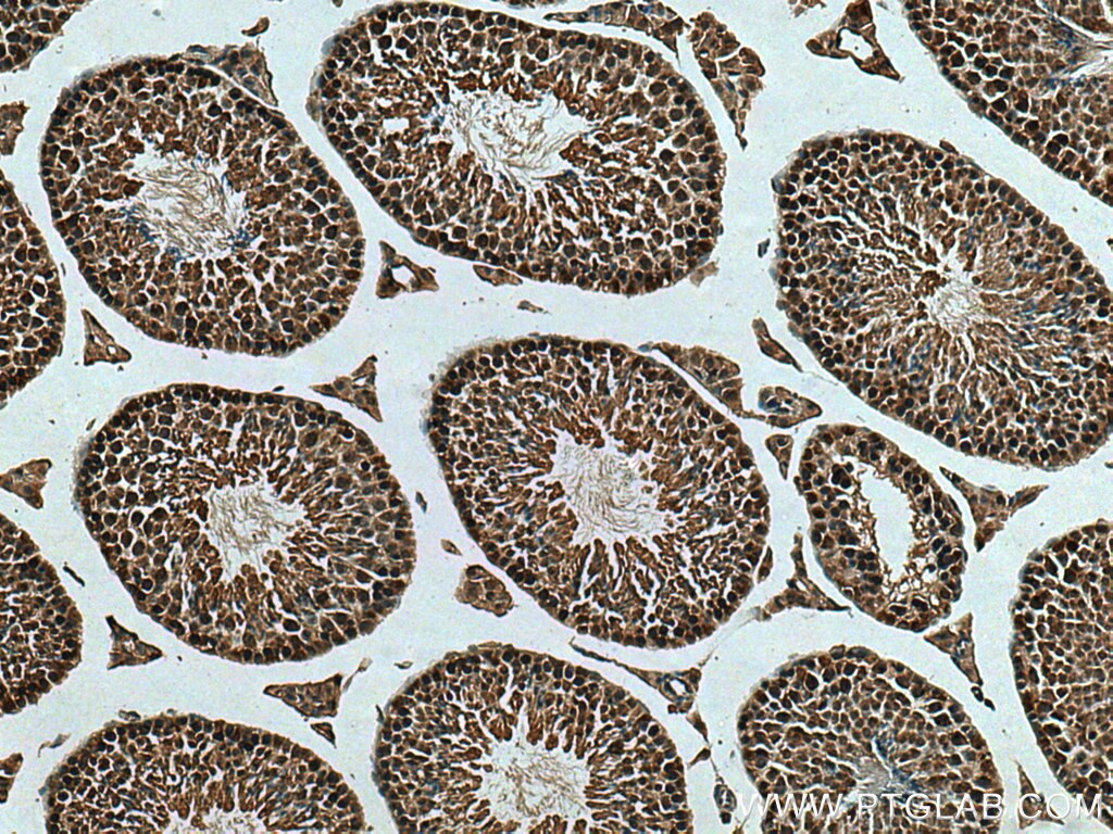 IHC staining of mouse testis using 28751-1-AP