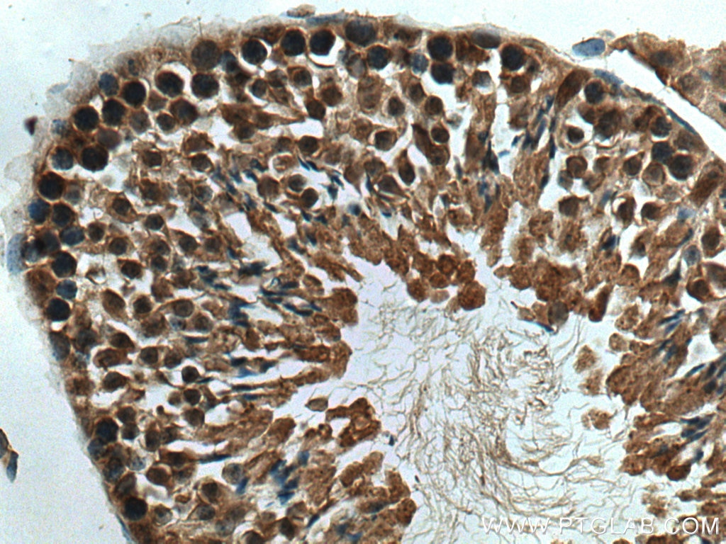 Immunohistochemistry (IHC) staining of mouse testis tissue using TRIM27 Polyclonal antibody (28751-1-AP)