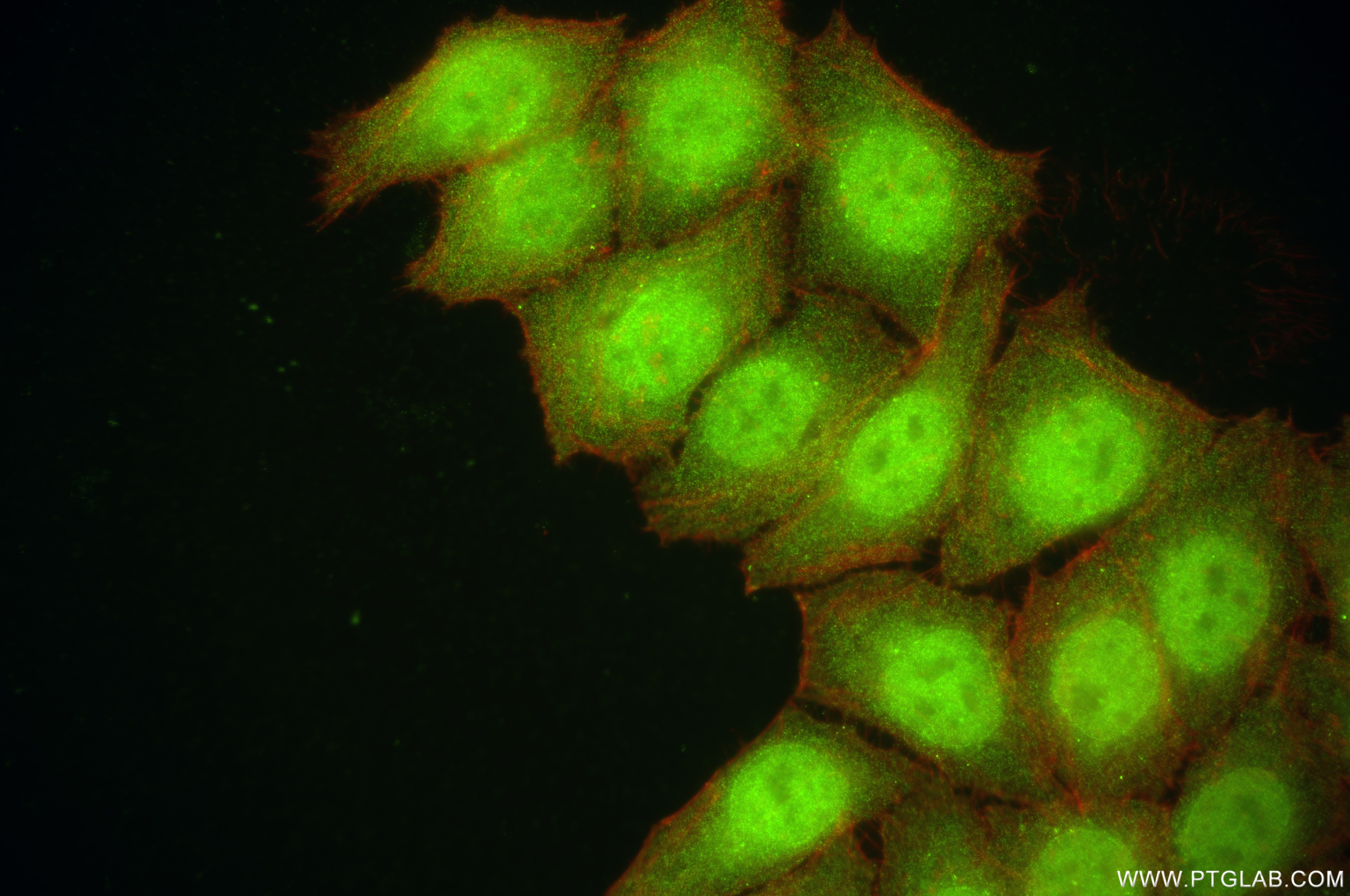 Immunofluorescence (IF) / fluorescent staining of HepG2 cells using TRIM27 Recombinant antibody (84927-6-RR)