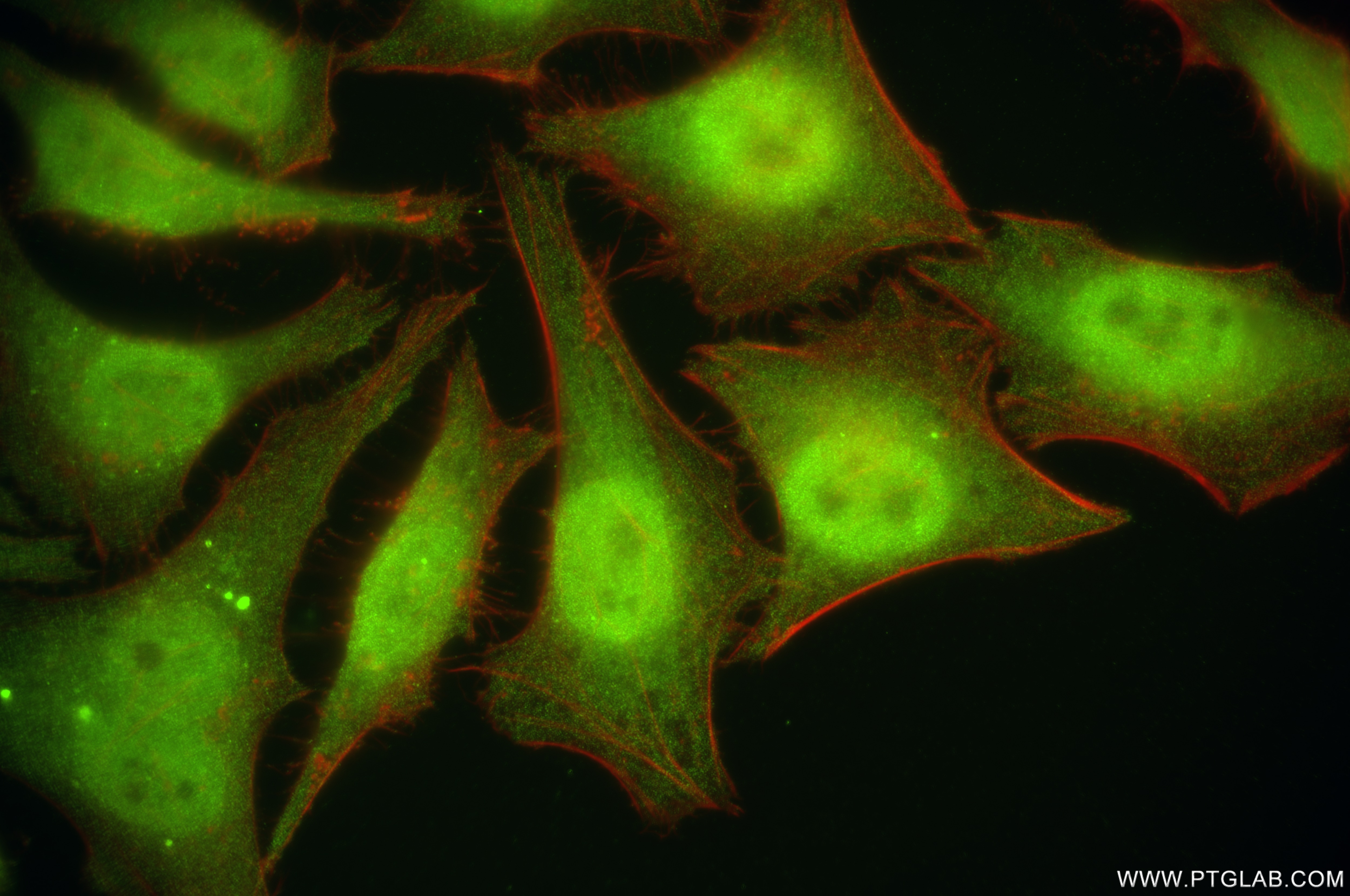 Immunofluorescence (IF) / fluorescent staining of HeLa cells using TRIM27 Recombinant antibody (84927-6-RR)