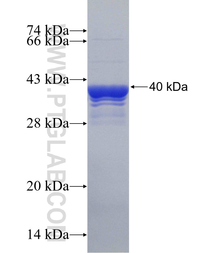 TRIM27 fusion protein Ag30576 SDS-PAGE