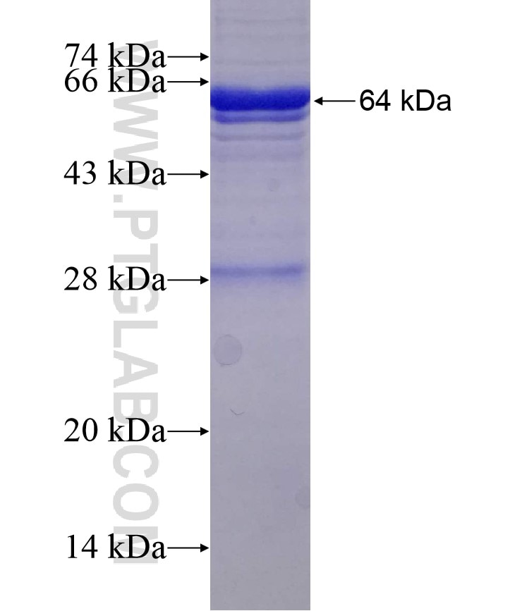 TRIM27 fusion protein Ag2849 SDS-PAGE