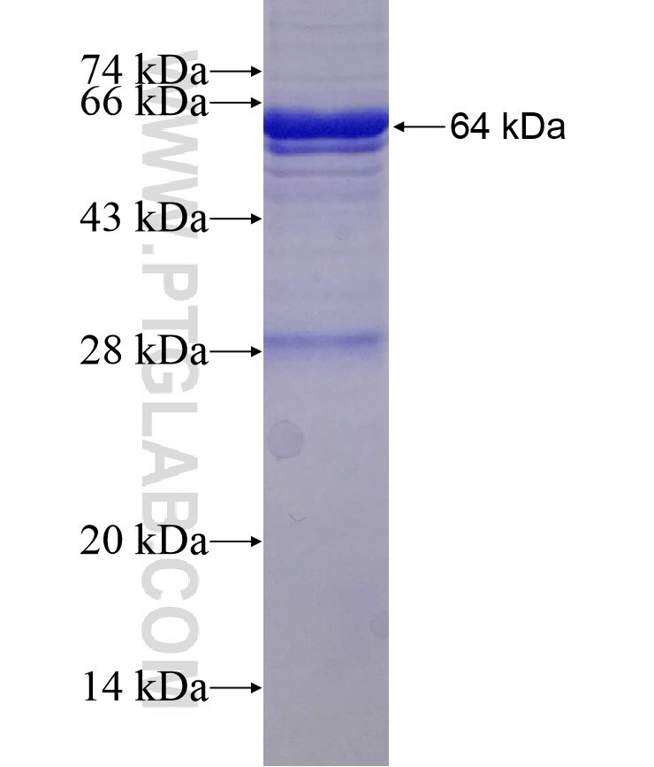 TRIM27 fusion protein Ag2849 SDS-PAGE