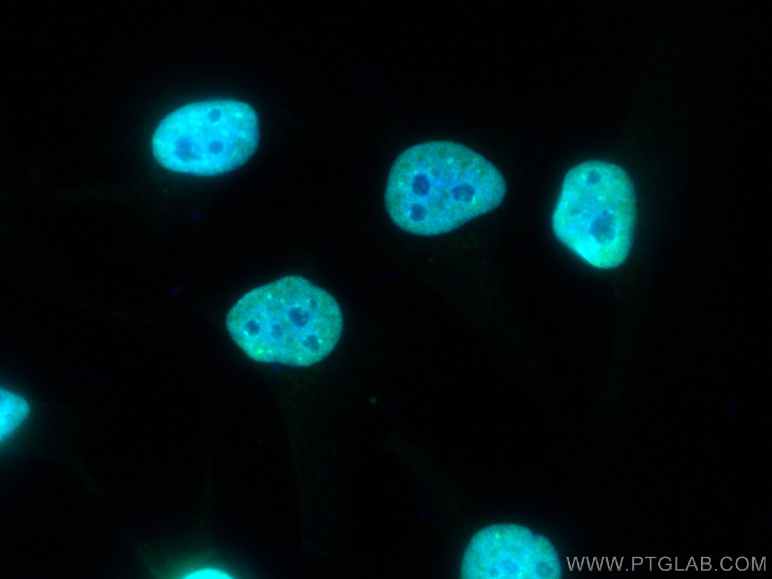 Immunofluorescence (IF) / fluorescent staining of HeLa cells using KAP1 Polyclonal antibody (15202-1-AP)