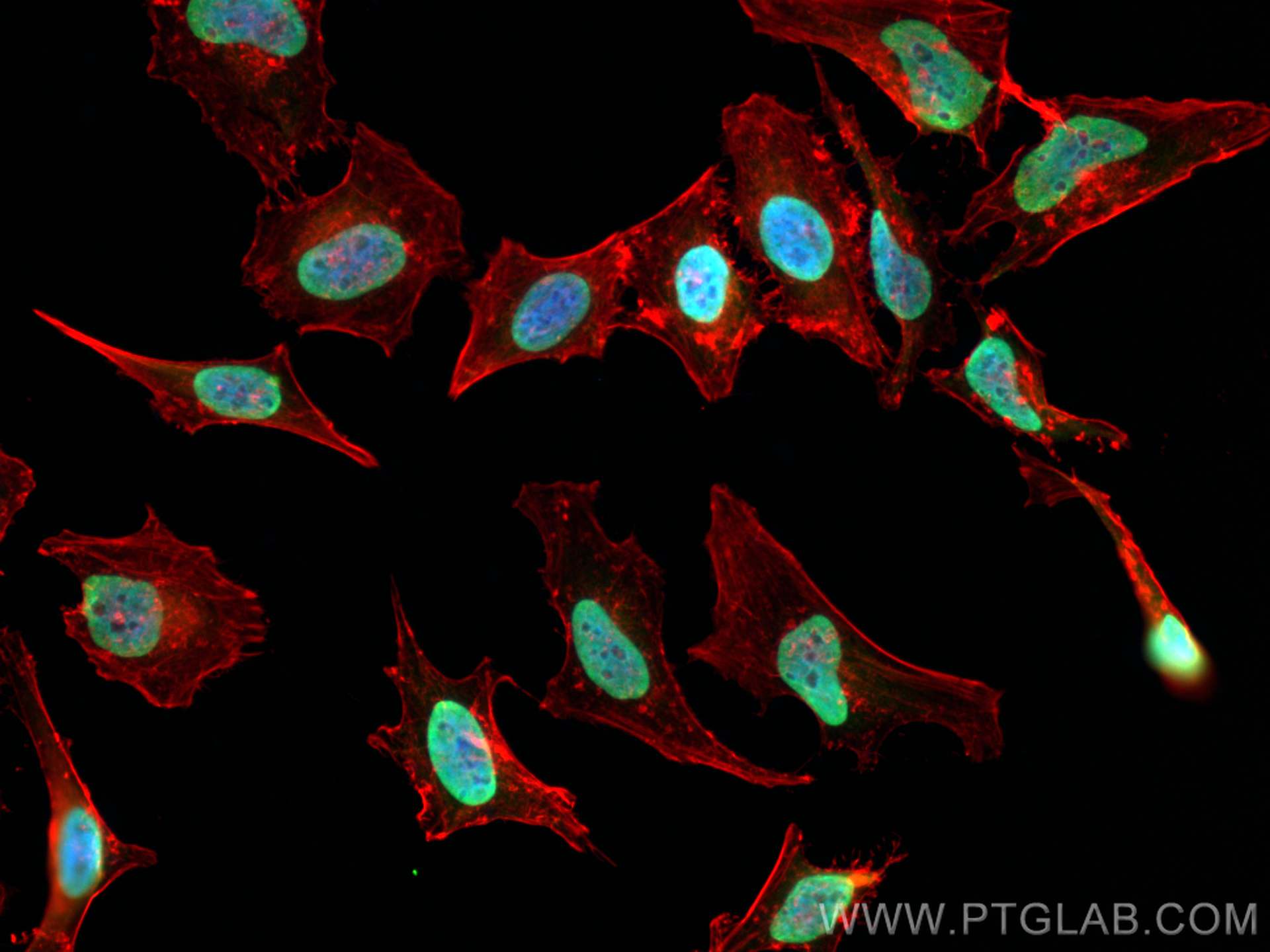 Immunofluorescence (IF) / fluorescent staining of HeLa cells using KAP1 Polyclonal antibody (15202-1-AP)