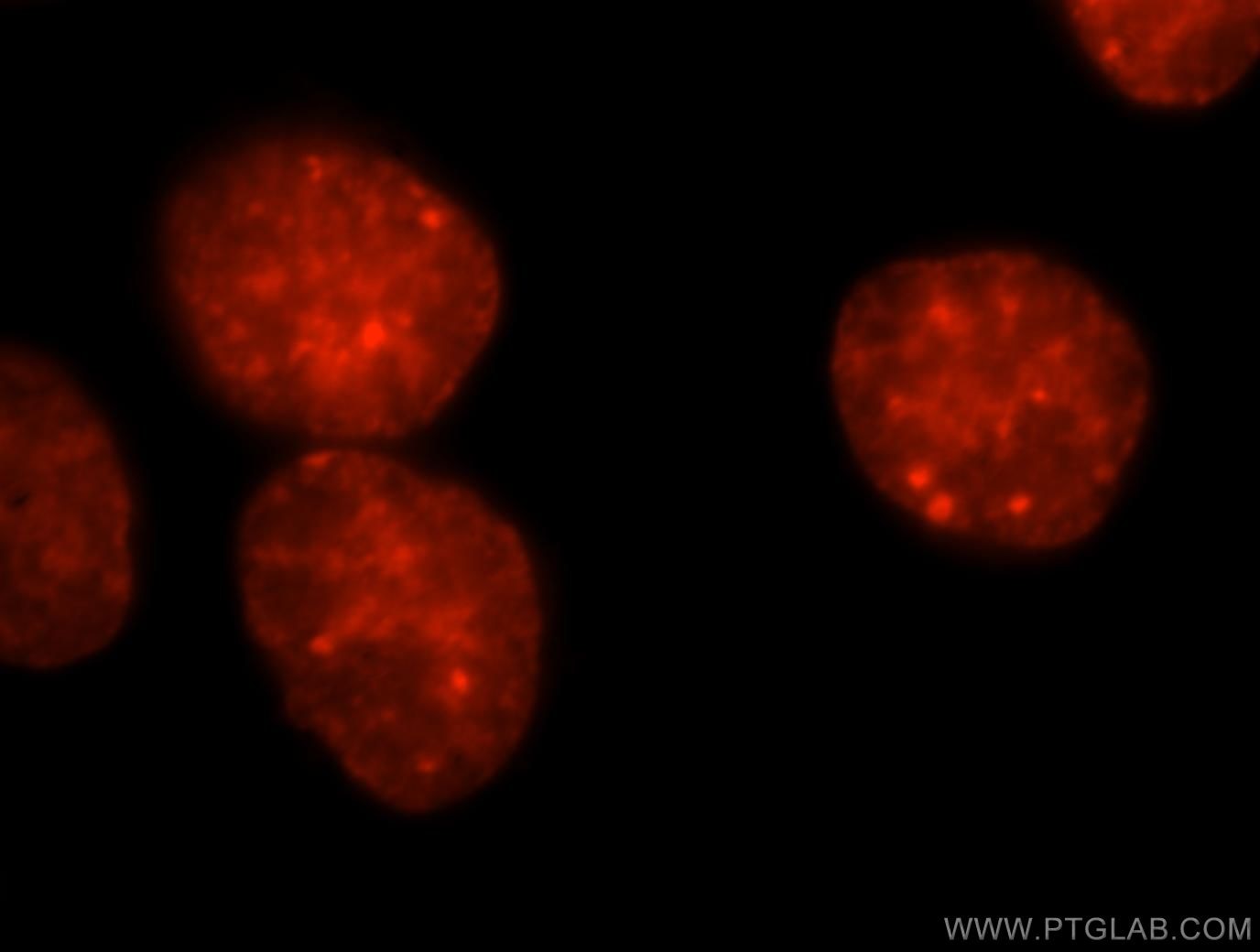 IF Staining of HeLa using 15202-1-AP