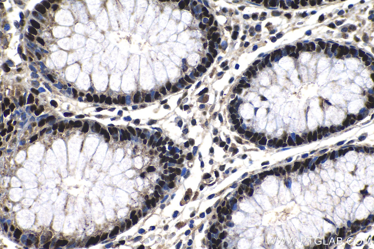 Immunohistochemistry (IHC) staining of human colon tissue using KAP1 Polyclonal antibody (15202-1-AP)