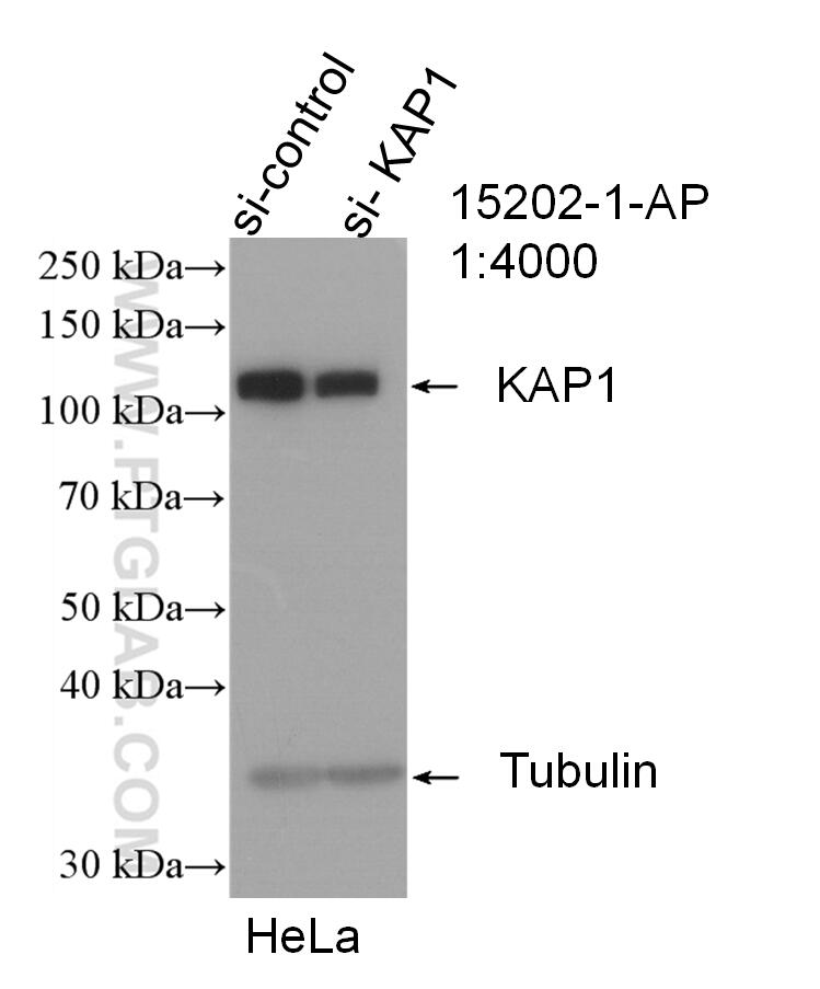 WB analysis of HeLa using 15202-1-AP