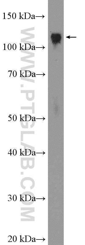 Western Blot (WB) analysis of rat spleen tissue using KAP1 Polyclonal antibody (15202-1-AP)