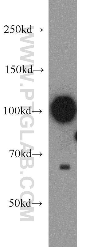 Western Blot (WB) analysis of HeLa cells using KAP1 Polyclonal antibody (15202-1-AP)